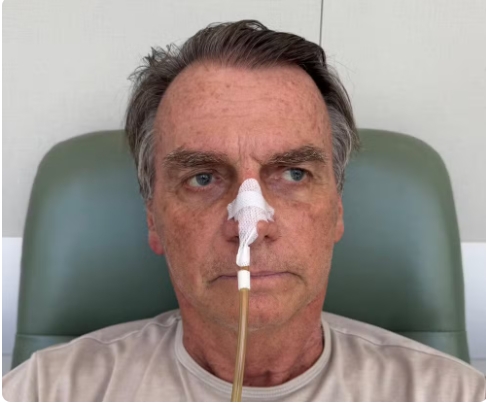 Bolsonaro tem ‘melhora progressiva’ nos exames do fígado e intestino, diz boletim