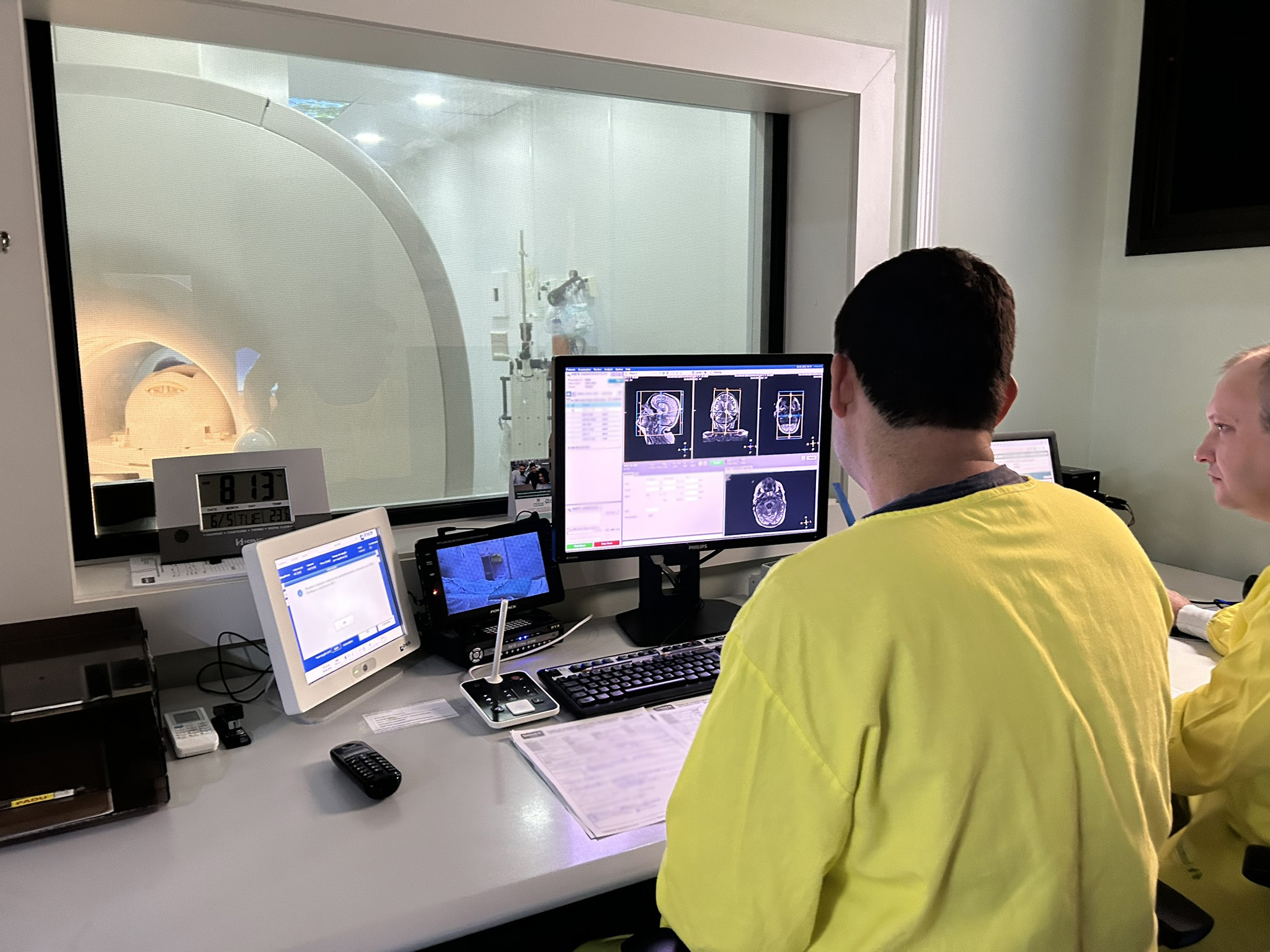 Unimed Missões/RS oferece serviço completo de diagnóstico por imagem