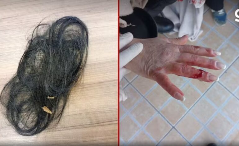 Suspeito de agredir e cortar cabelo da ex-companheira com facão é preso em Fontoura Xavier