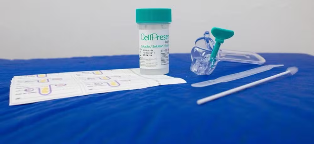 SUS passa a oferecer novo teste para detectar câncer do colo do útero