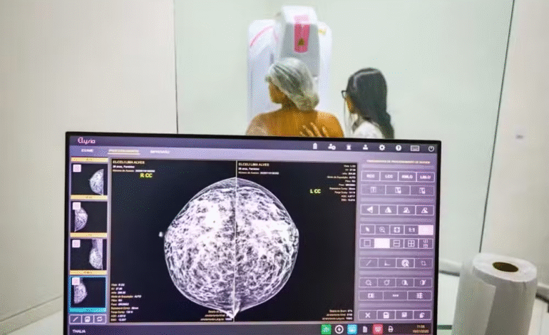Ministério da Saúde passa a recomendar mamografia a partir dos 40 anos