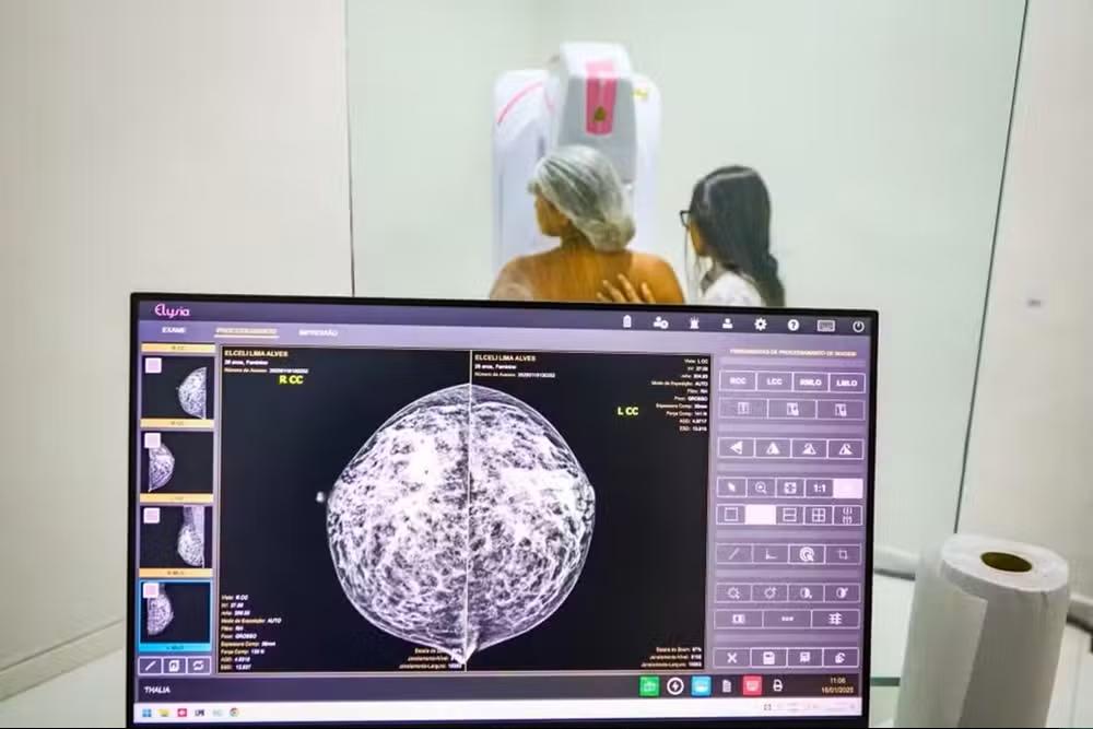 Ministério da Saúde passa a recomendar mamografia a partir dos 40 anos