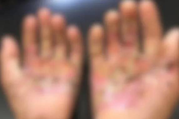 Mulher é presa por suspeita de queimar mãos do filho no fogão e jogar sal nas feridas