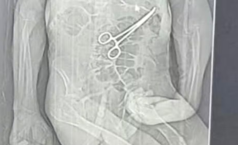 Idoso morre após cirurgias em hospital de MG e família aponta pinça esquecida no corpo