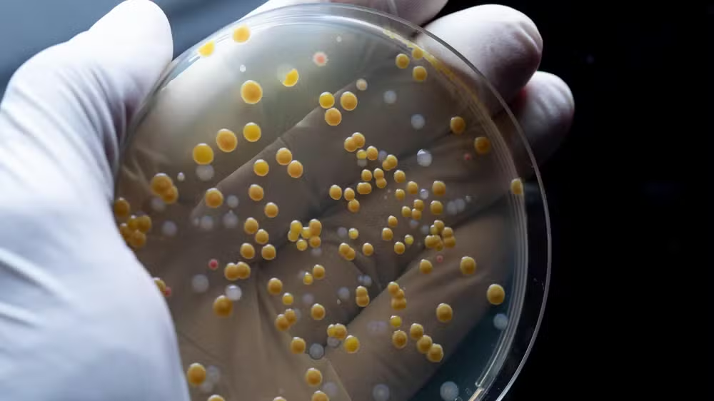 UFRGS identifica bactéria multirresistente em pontos do Guaíba, em Porto Alegre