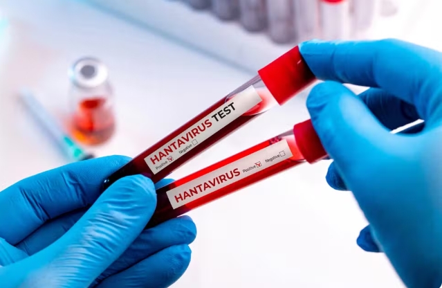 RS registra duas infecções em áreas rurais e um óbito de Hantavírus