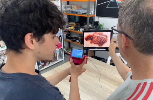 Estudantes do RS criam dispositivo portátil com IA para detectar câncer de pele